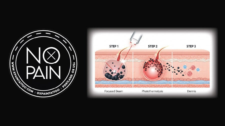 How No Pain Tattoo Numbing Cream Makes Laser Tattoo Removal Bearable - No Pain Tattoo