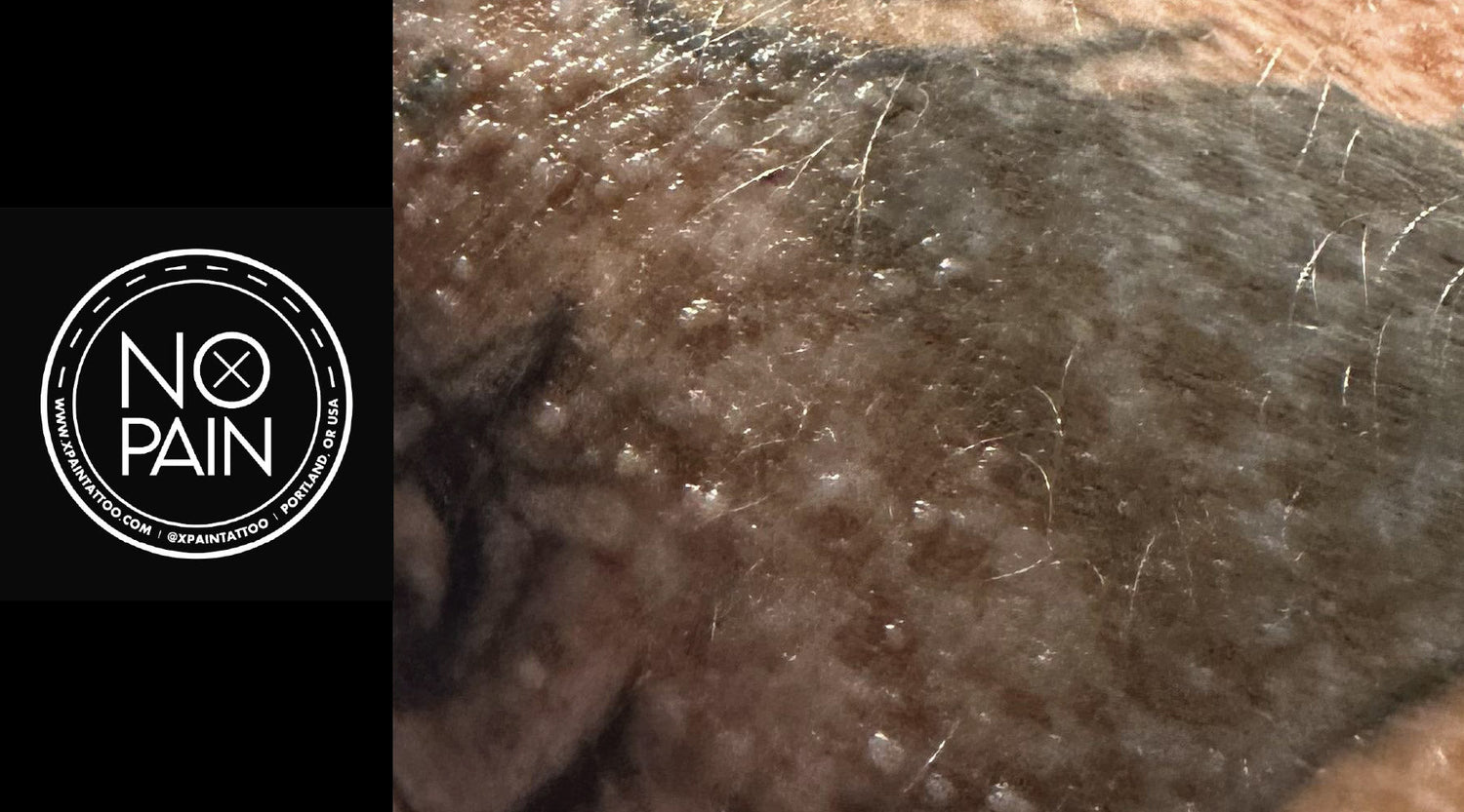 What Are These Small Bumps on My New Tattoo? A Guide to Rashes and Pim ...