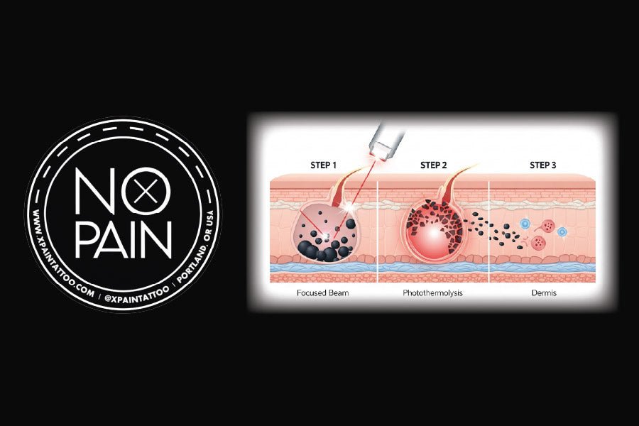 How No Pain Tattoo Numbing Cream Makes Laser Tattoo Removal Bearable - No Pain Tattoo